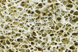 Magnified image of bone